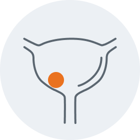 Bladder graphic