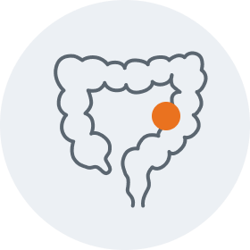 Colorectal graphic