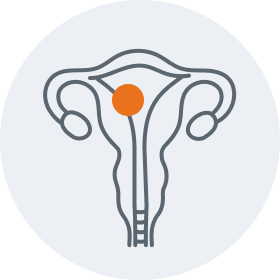 Endometrial graphic