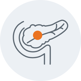 Pancreatic graphic